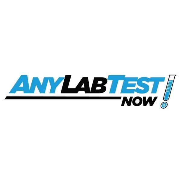 Lab Test