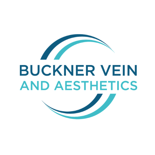 Buckner Vein