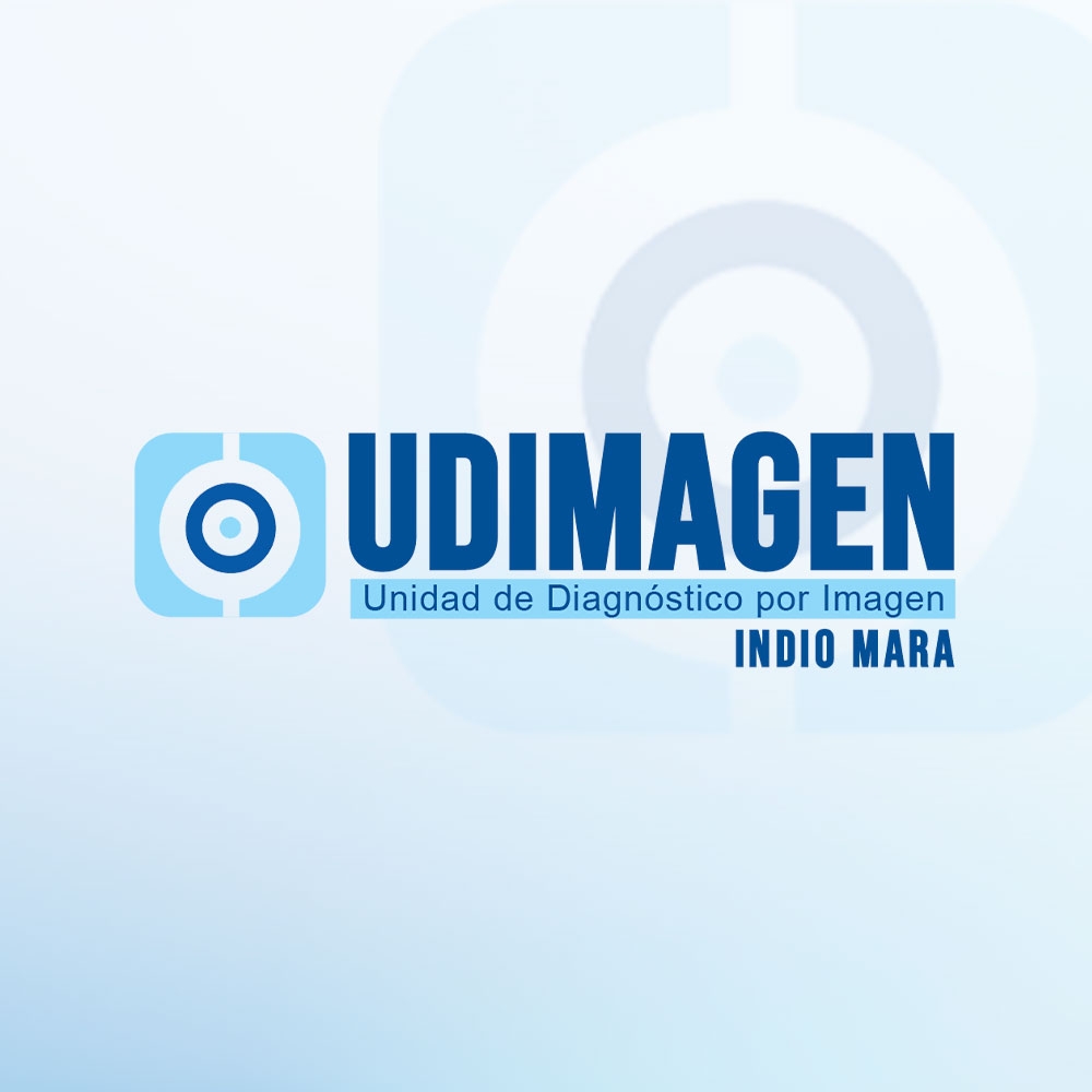 Udimagen